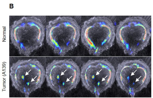 암 줄기세포만 콕 집어 빛 밝히는 형광물질 개발 사진