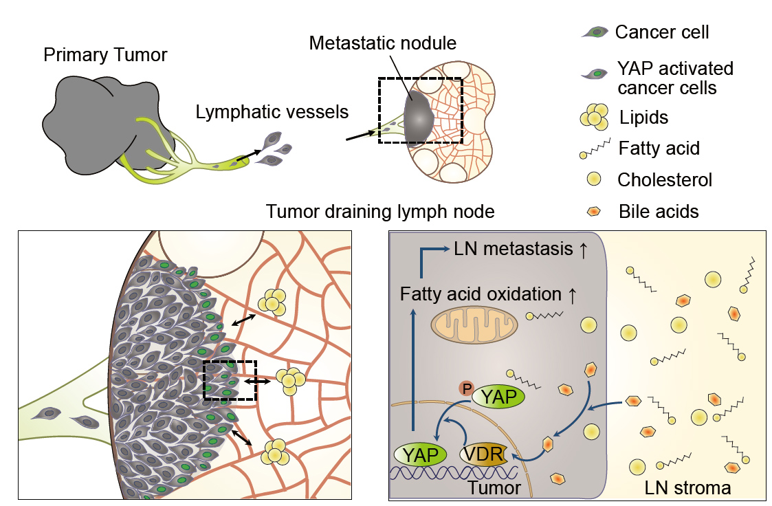 Tumor metastasis to lymph node requires metabolic reprogramming to use fatty acid as a fuel 사진