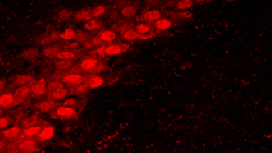  virus image 2