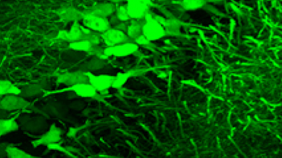  virus image 3