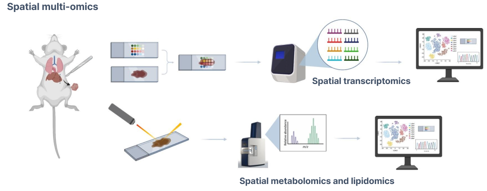 Spatial metabolomic and lipidomic analysis of liver diseases using MALDI mass spectrometry imaging