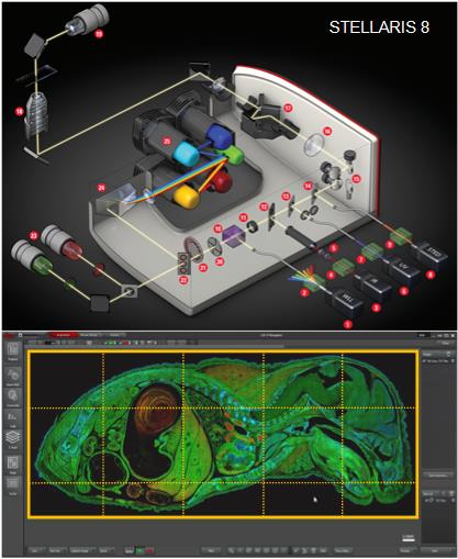 초해상력 공초점 레이저 주사현미경 관련 사진