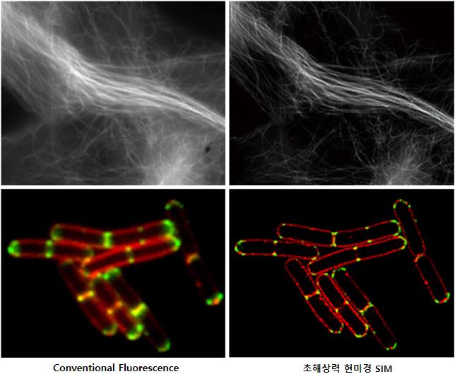 초해상력 현미경 SIM 관련 사진